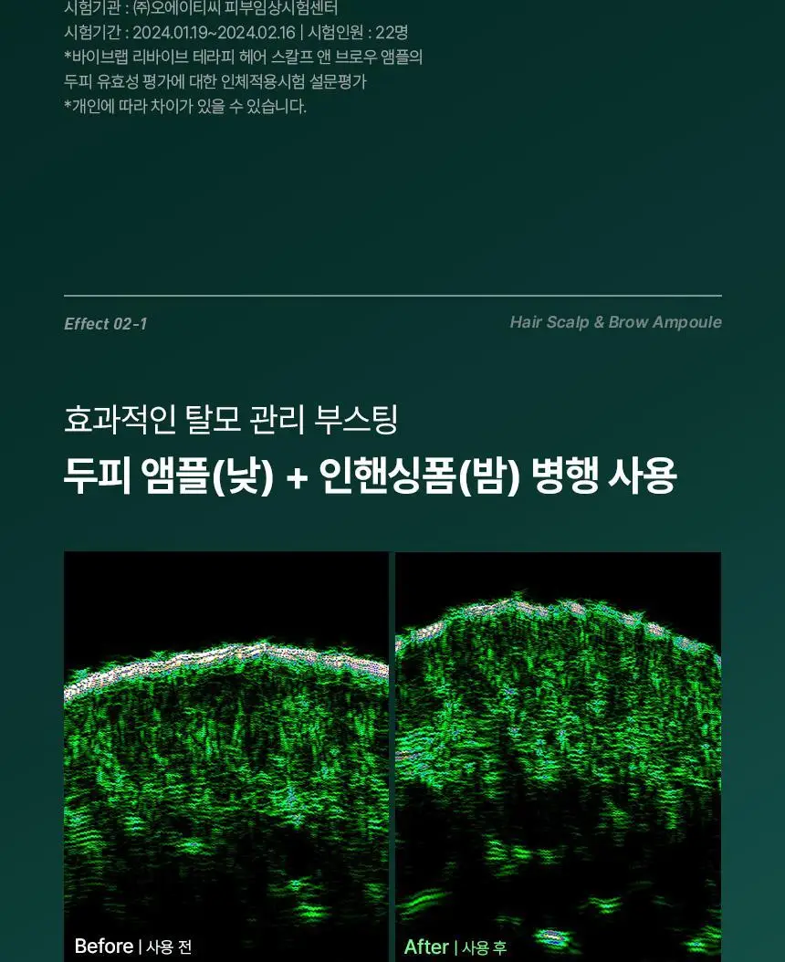 [2025어워즈/2년연속수상] 바이브랩 리바이브 테라피 헤어 스칼프 앤 브로우 앰플 더블기획 상세페이지 25